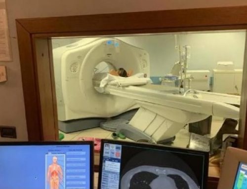 Quante radiazioni assorbi dalla tac o dalla mammografia? Ora l’esposizione ai raggi X sarà indicata sul referto degli esami